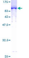 Human IKZF3 / AIOLOS Protein (Recombinant GST)