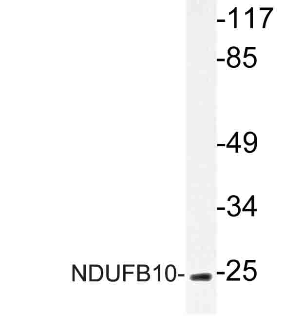 NDUFB10 Antibody (Glu95)