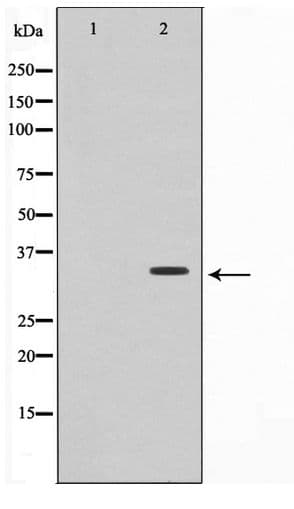 TNFRSF6B / DCR3 Antibody