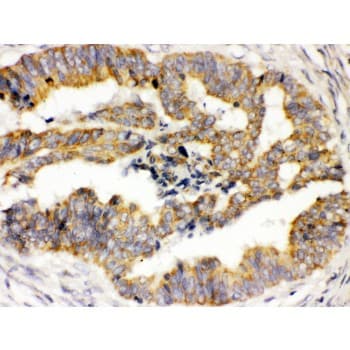 TRPM4 Antibody (aa1079-1214)