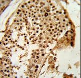 Polyclonal Rabbit anti-Human PARD3 Antibody (aa1329-1356, IHC, WB)