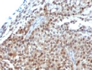 CDKN1A / WAF1 / p21 Antibody (clone CIP1/823 + DCS-60.2)