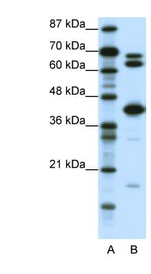 Polyclonal Rabbit anti-Human E2F2 Antibody (aa191-240, IHC, WB)