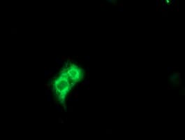 METAP2 Antibody (clone OTI1F6)