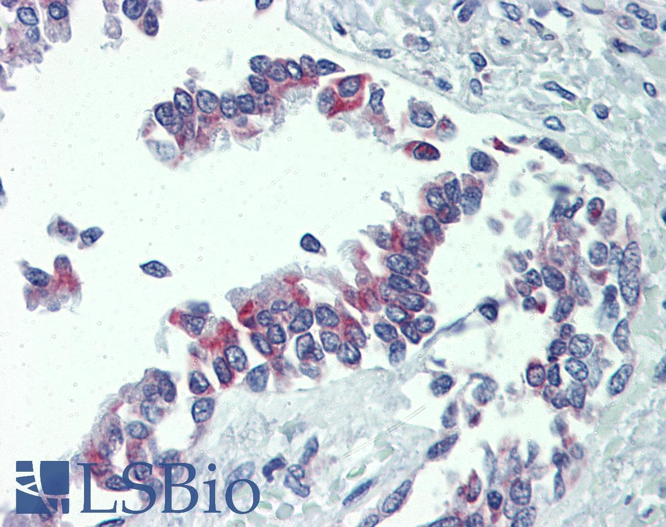 IHC-plus™ BAK1 / BAK Antibody