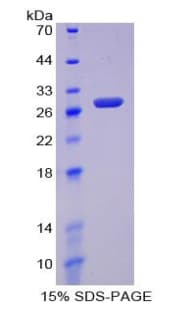 Human SIRPA / CD172a Protein (Recombinant His, N-Terminal)