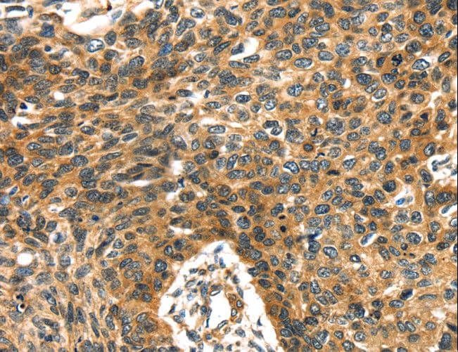PRSS50 / TSP50 Antibody