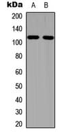 EPHA1 / EPH Receptor A1 Antibody (phospho-Tyr605)