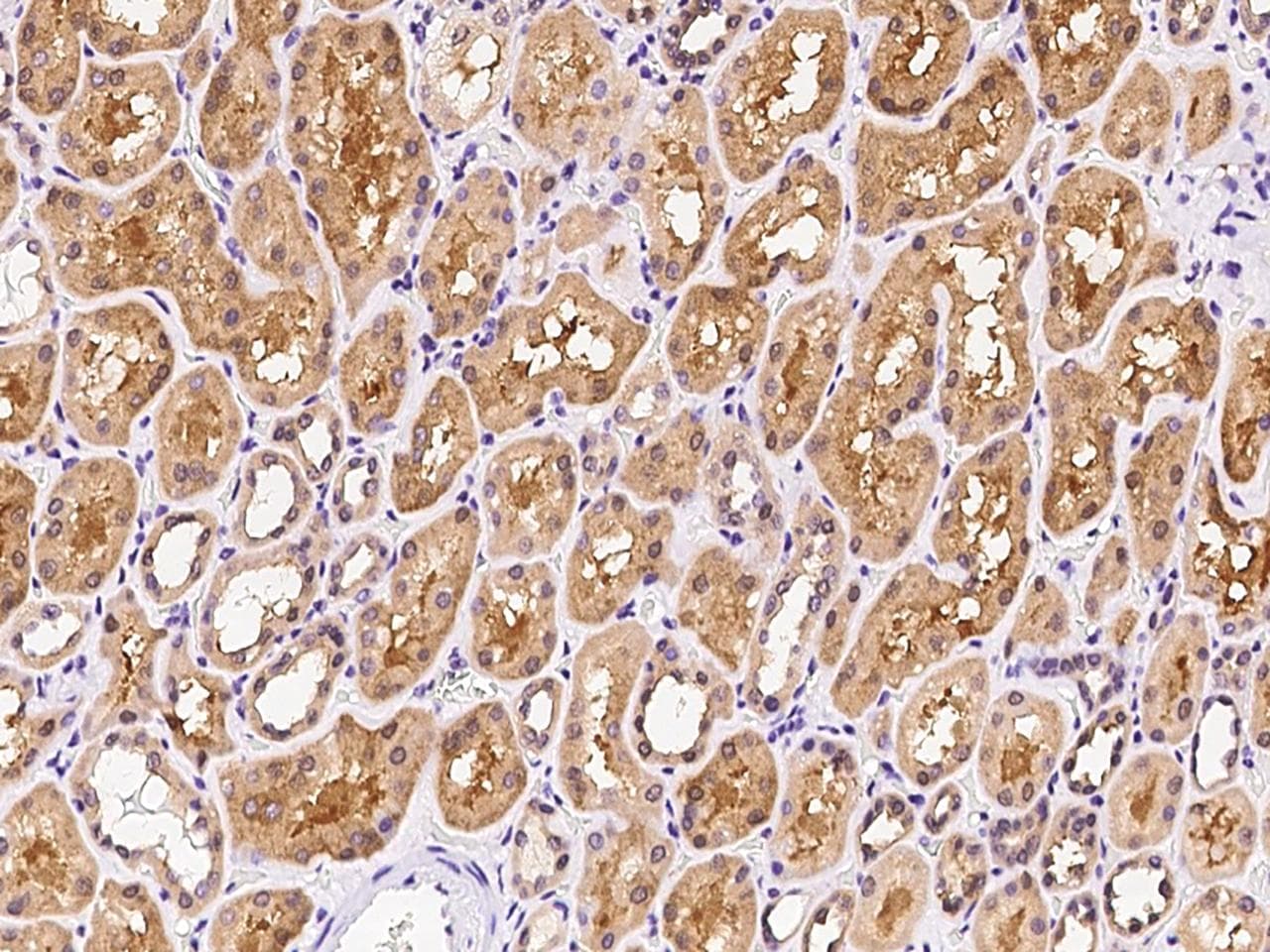NUDT5 Antibody