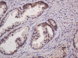 HSPD1 / HSP60 Antibody (clone OTI3G10)