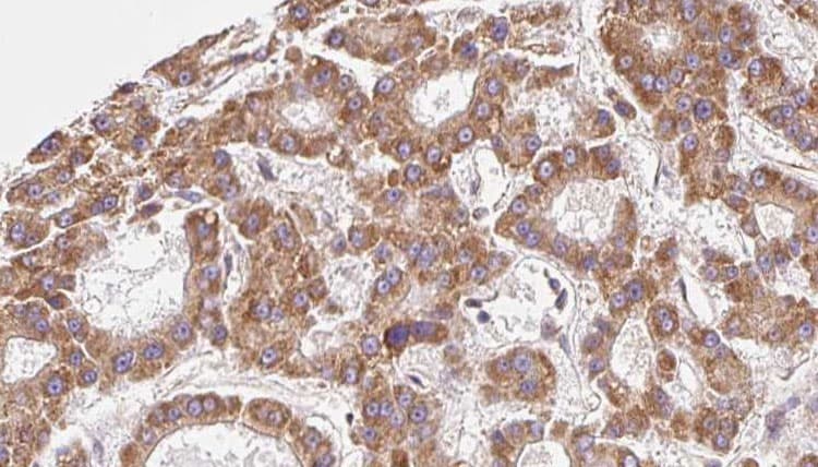 SLC16A9 Antibody