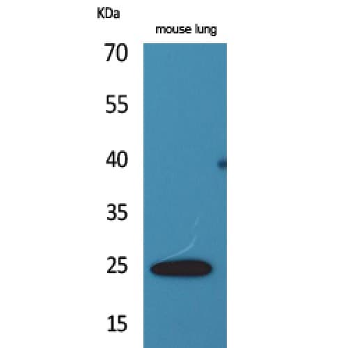 EDN1 / Endothelin 1 Antibody (Internal)