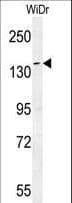 DAAM1 Antibody (aa341-370)
