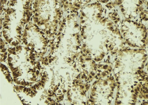 NUDT21 Antibody