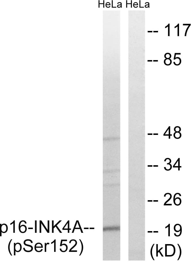 p16INK4a / CDKN2A Antibody (phospho-Ser152)
