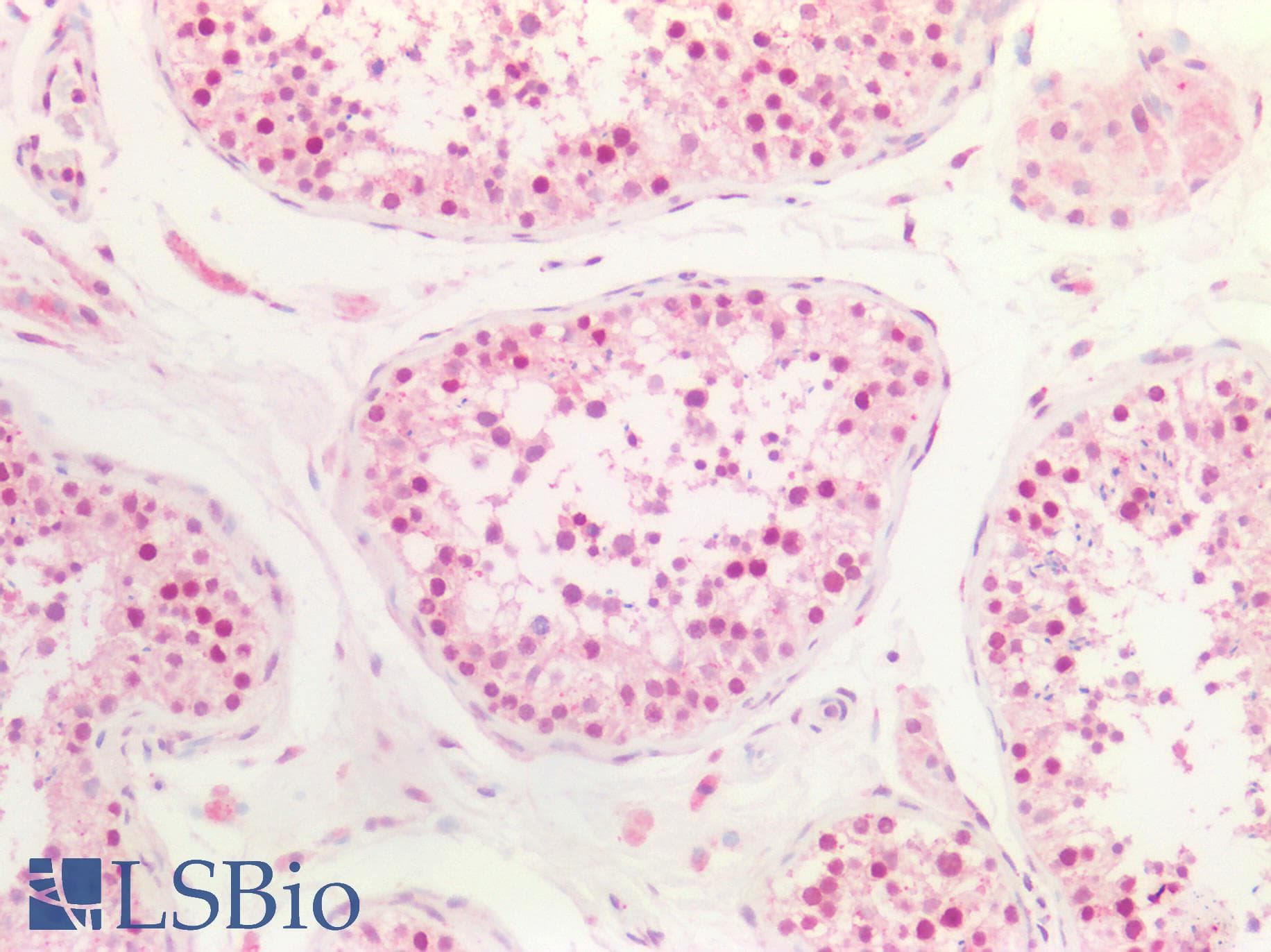 PathPlus™ MEN1 / Menin Antibody (aa575-C-term)