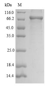 Mouse MASP2 / MASP-2 Protein (Recombinant 6His, N-terminus)