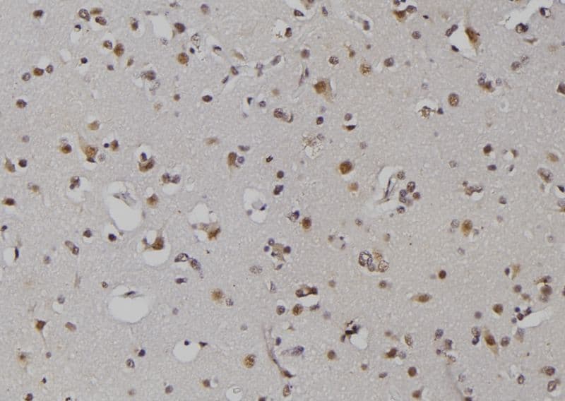 ZNRD1 Antibody