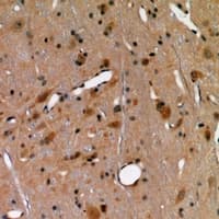 Polyclonal Rabbit anti-Human CLP / COTL1 Antibody (IHC, WB)