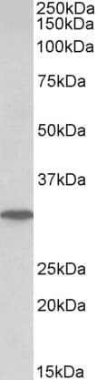 IHC-plus™ PNP / Nucleoside Phosphorylase Antibody (aa142-153)