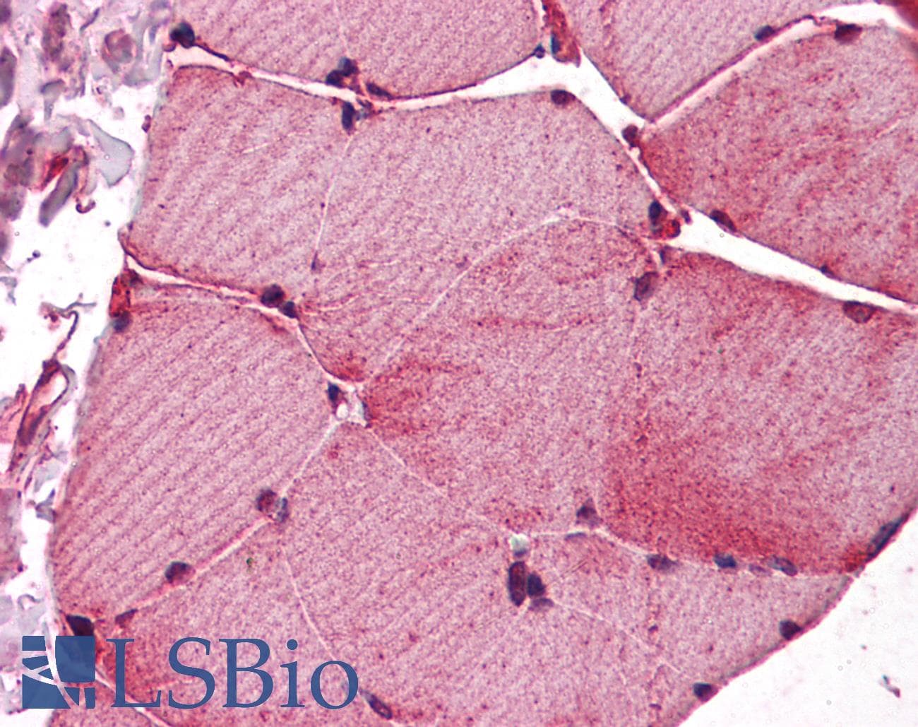 IHC-plus™ FKTN / Fukutin Antibody