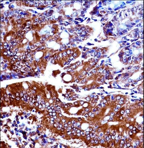 NPRA / NPR1 Antibody (aa198-226)