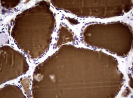 NBN / Nibrin Antibody (clone OTI6H7)
