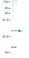 Human PSENEN / PEN-2 Protein (Recombinant GST)