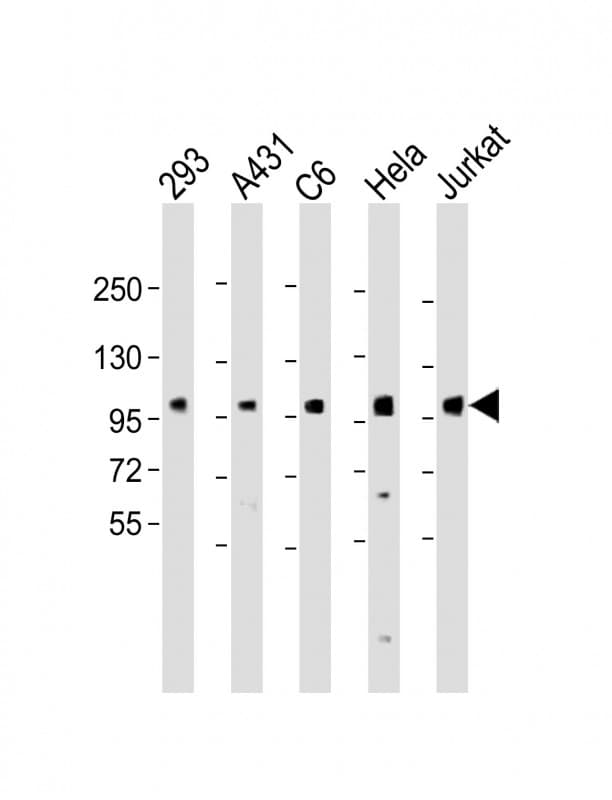 EEF2K Antibody (Ser366)
