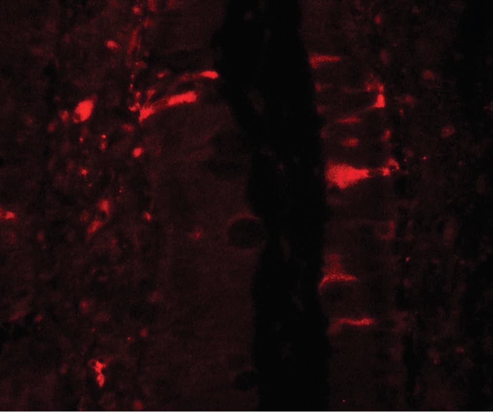 IHC-plus™ IL36RN / IL1F5 Antibody