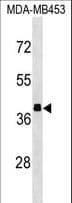 ALDOB Antibody (aa31-60)