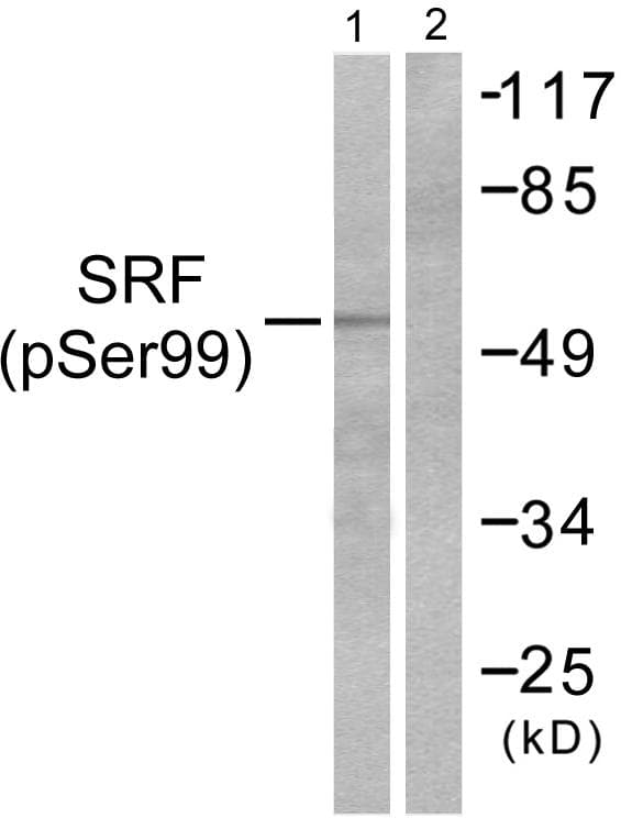 SRF / Serum Response Factor Antibody (phospho-Ser99)