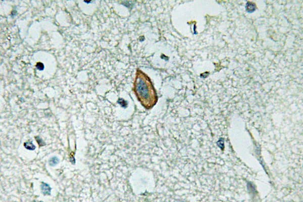 KCNMA1 / BK Antibody (aa721-770)