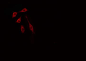 FRA-1 / FOSL1 Antibody