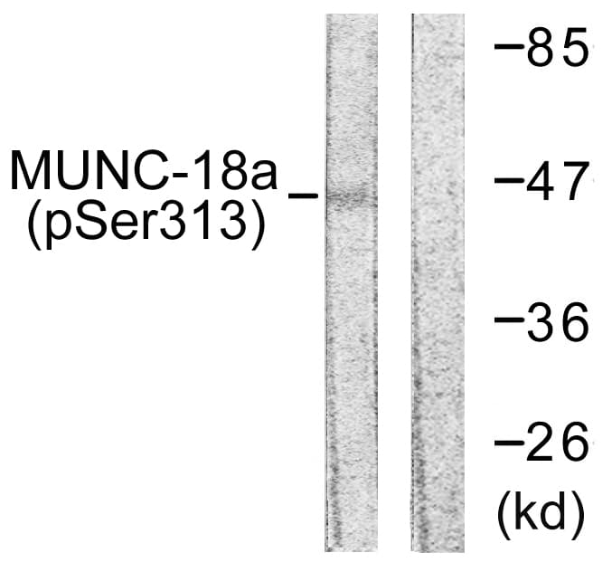 STXBP1 / MUNC18-1 Antibody (phospho-Ser313)