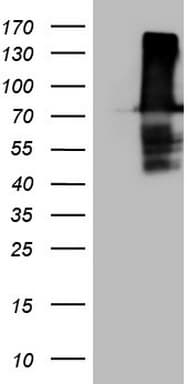 URP2 / FERMT3 Antibody (aa259-528, clone OTI3C7)