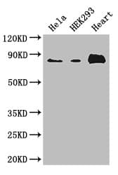 Polyclonal Rabbit anti-Human ABLIM1 Antibody (IHC, IF, WB)