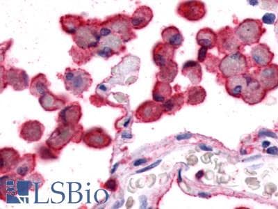 PathPlus™ ADGRE5 / CD97 Antibody (N-Terminus)
