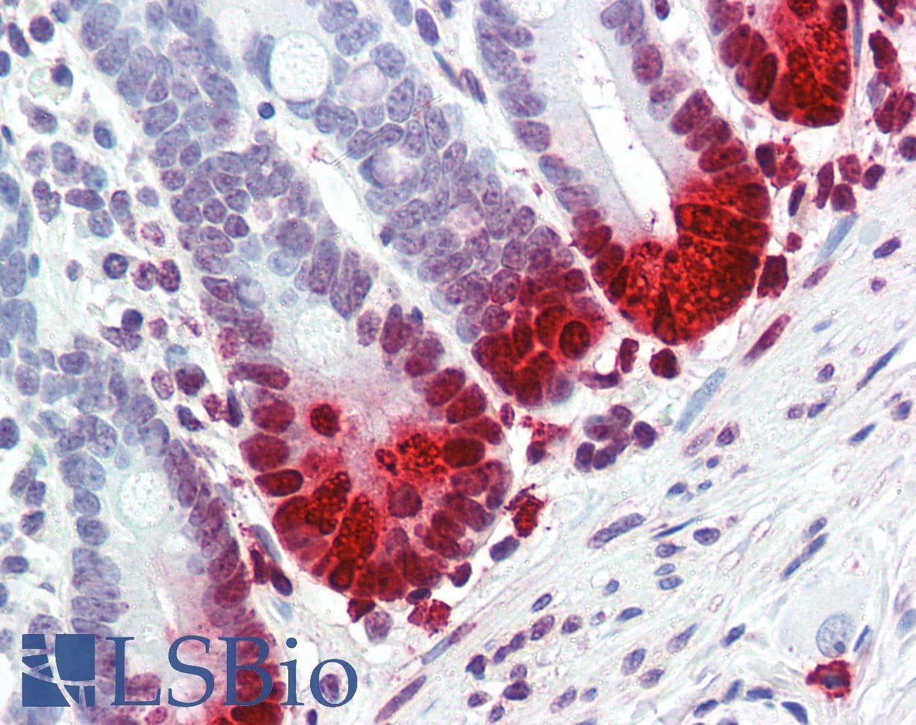 IHC-plus™ Monoclonal Mouse anti-Human DEFA5 / Defensin 5 Antibody (IHC, IF, WB)