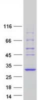 Human SPATA25 Protein (Recombinant Myc-DDK (Flag))