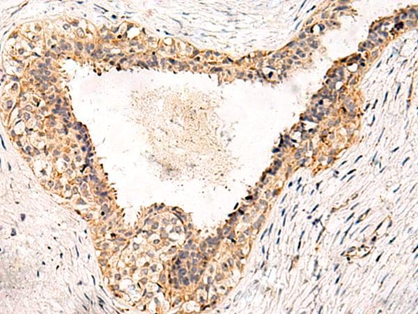 Polyclonal Rabbit anti-Human GPR152 Antibody (IHC, WB)