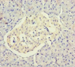 Dynactin 3 / DCTN3 Antibody (aa2-176)
