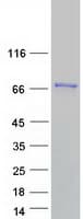 Human PLS3 / T Plastin Protein (Recombinant Myc-DDK (Flag))