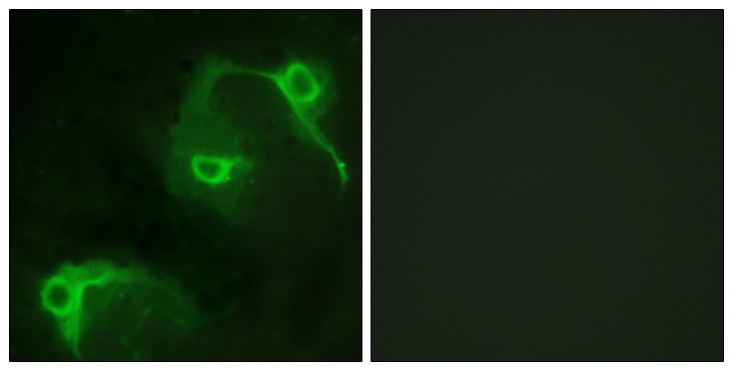 Polyclonal Rabbit anti-Human VAV2 Antibody (aa108-157, IHC, IF, WB)