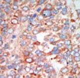 Polyclonal Rabbit anti-Human STK24 / MST3 Antibody (aa345-374, IHC, WB)