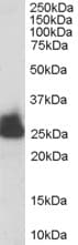 IHC-plus™ TPI1 / TPI Antibody (aa274-286)