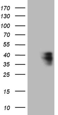 CTSL / Cathepsin L Antibody (clone OTI2F1)