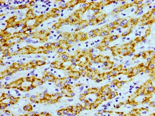 AGXT / SPT Antibody