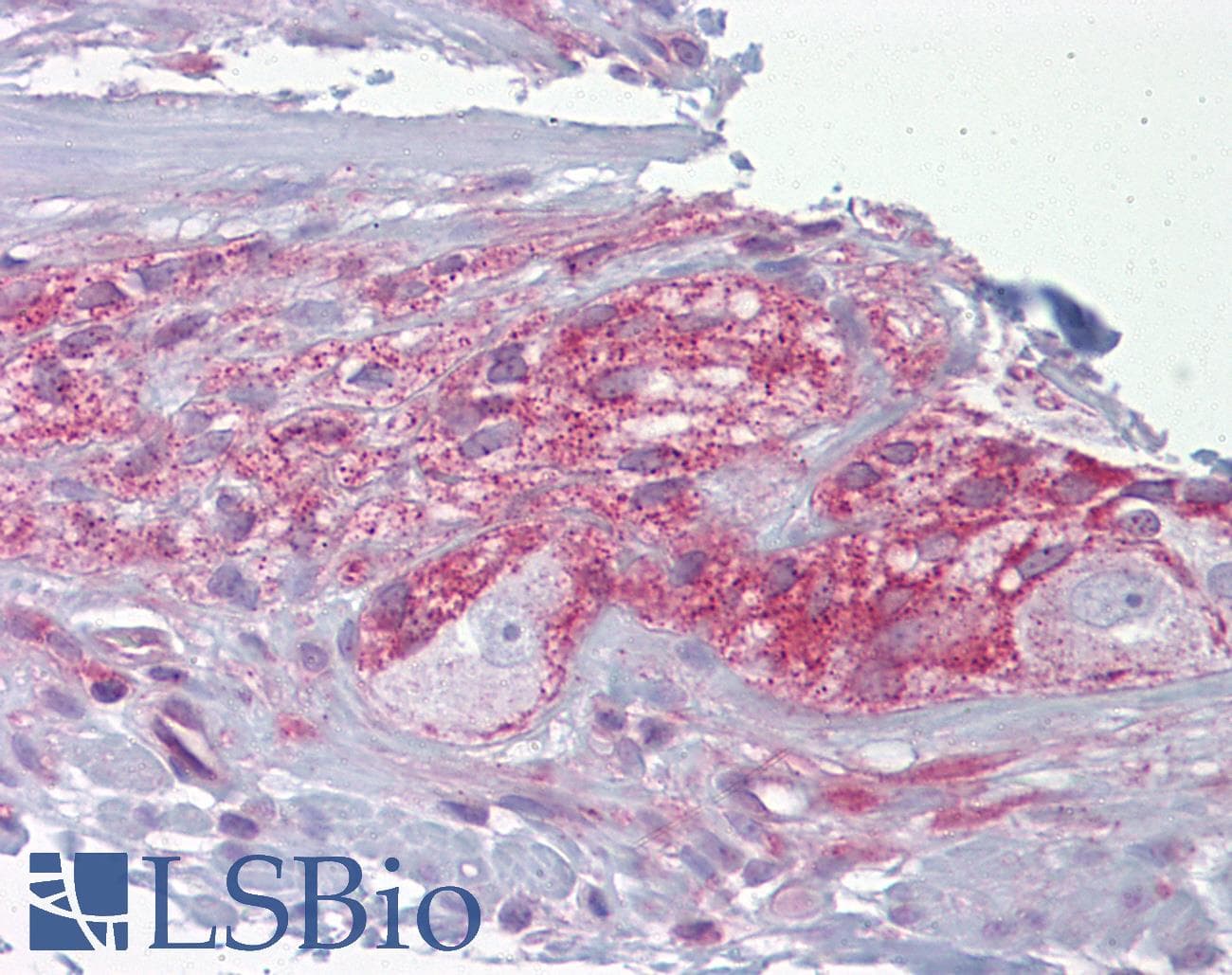 Polyclonal Rabbit anti-Human NCS1 / Neuronal Calcium Sensor Antibody (C-Terminus, IHC, WB)
