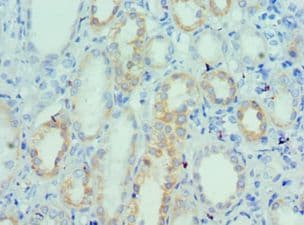 UTS2 / Urotensin II Antibody (aa35-124)